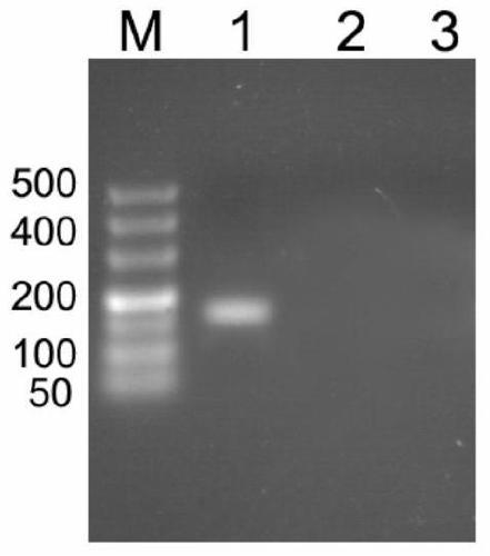 A primer, kit and detection method for detecting channel catfish virus using pyrosequencing technology