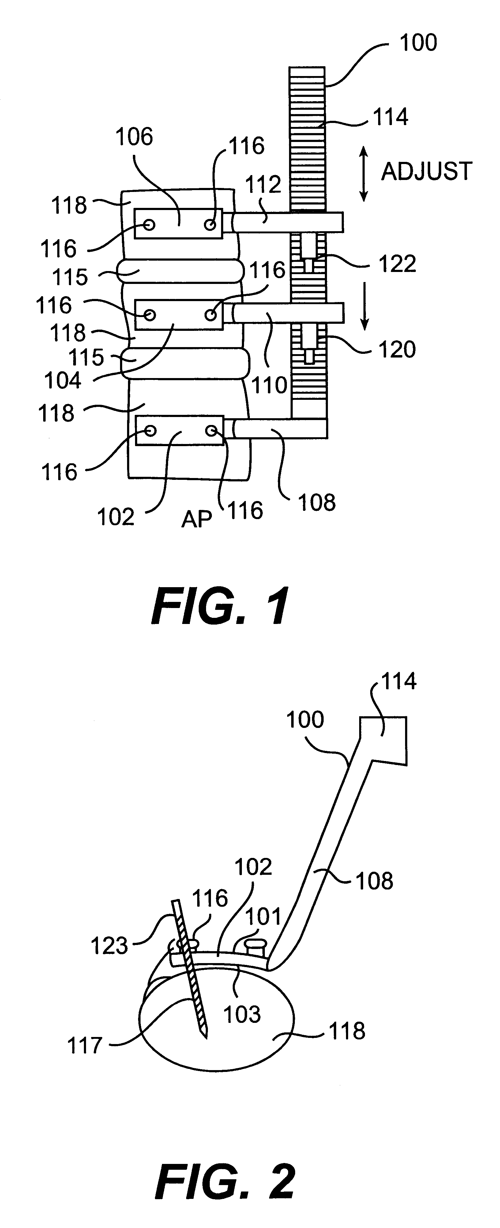 Spinal fusion instrumentation system