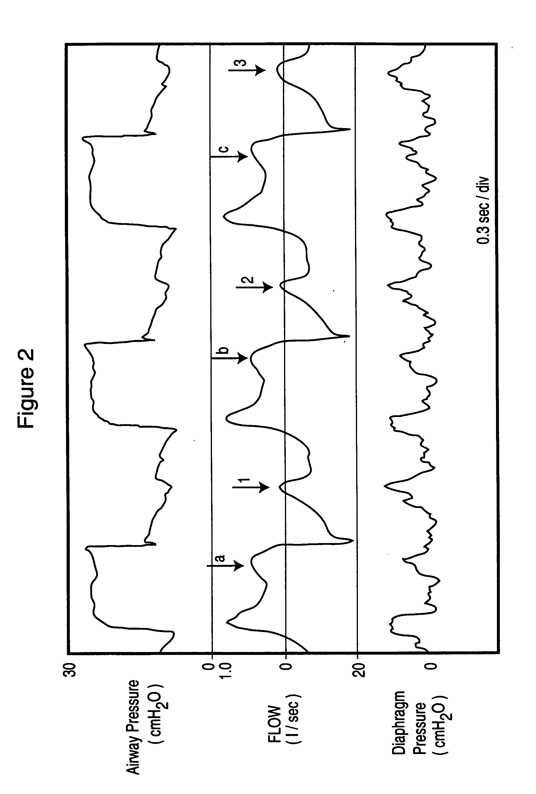 Method and device for monitoring and improving patient-ventilator interaction