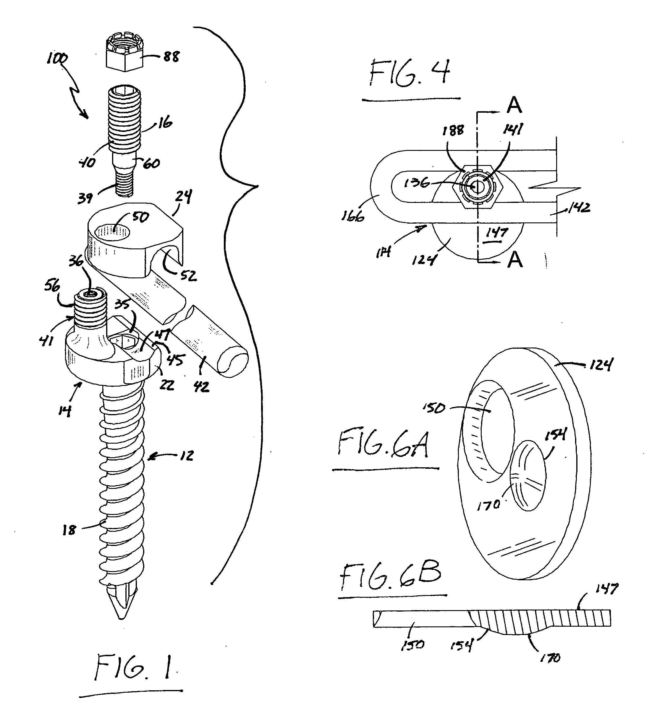 Rod and plate system for incremental reduction of the spine