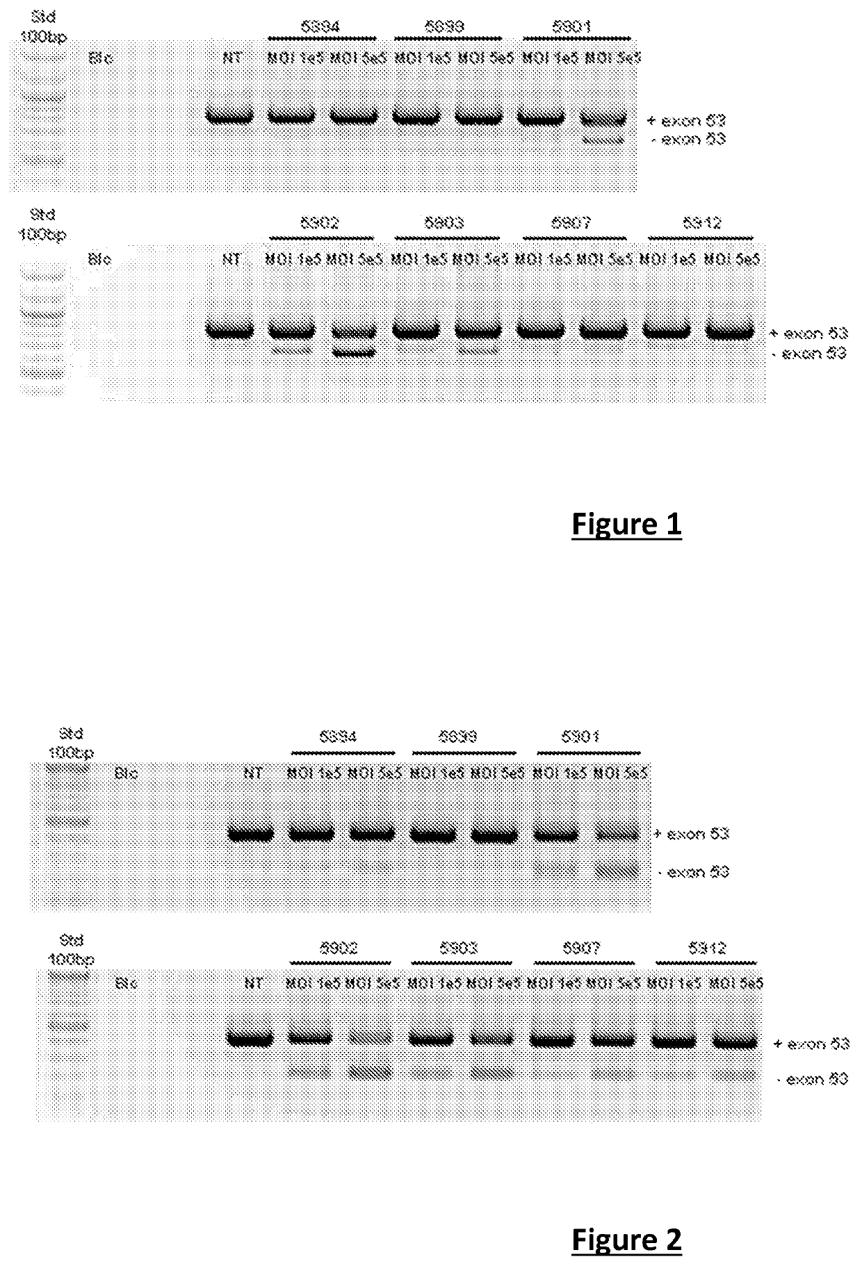 Effective gene therapy tools for dystrophin exon 53 skipping