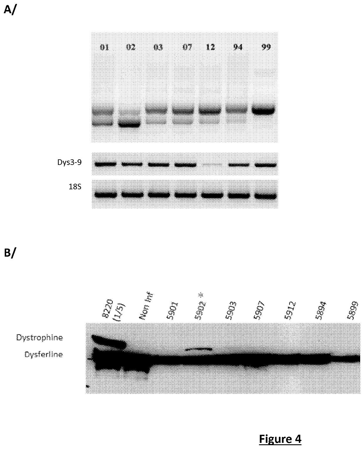 Effective gene therapy tools for dystrophin exon 53 skipping