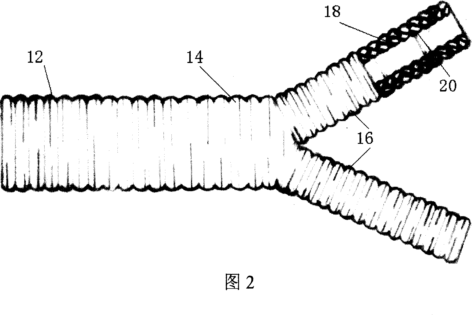 Artificial blood vessel collagen pre-coagulation coating