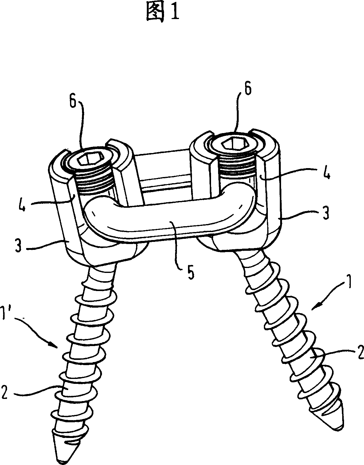 Dynamic stabilization device for bones or vertebrae