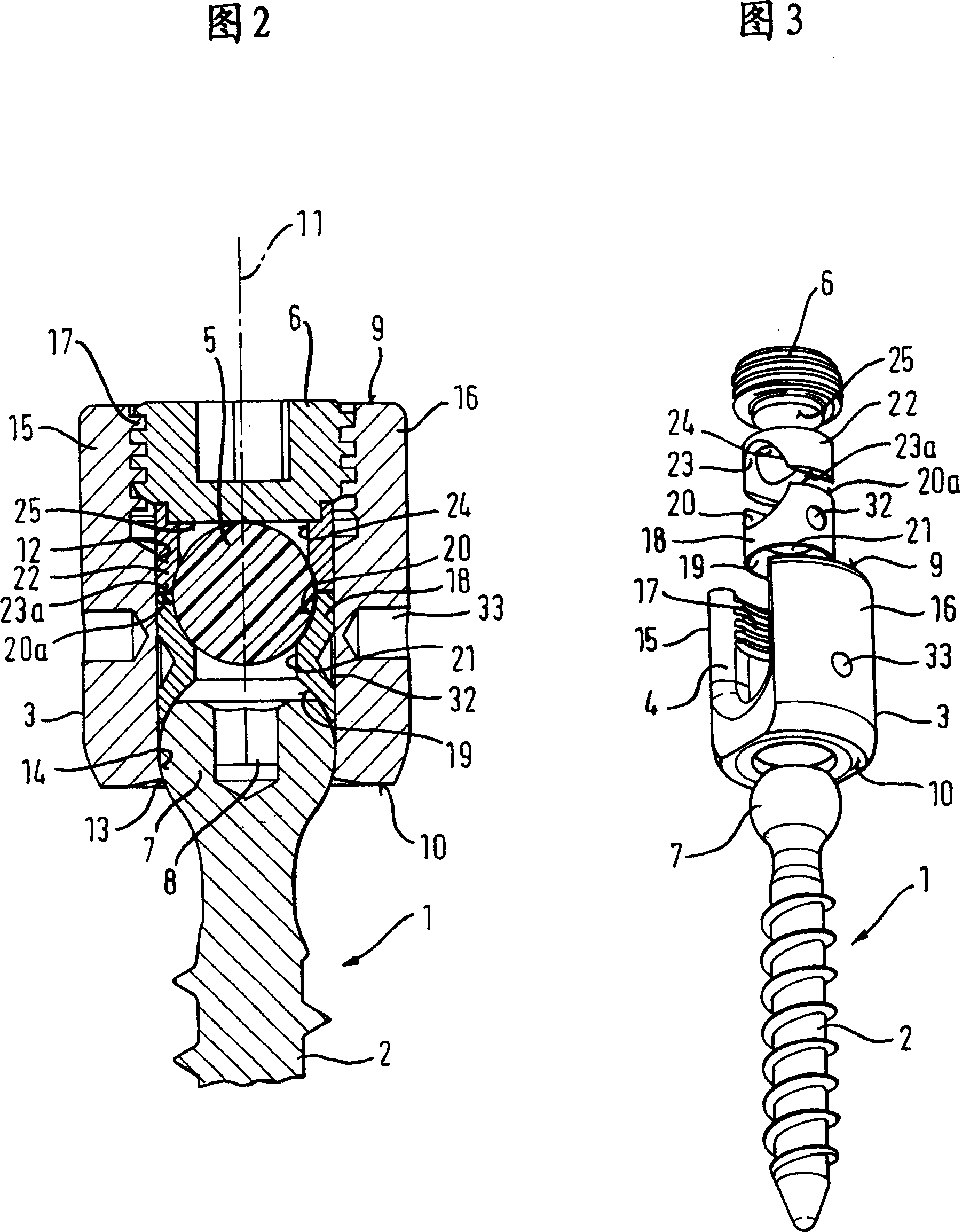 Dynamic stabilization device for bones or vertebrae