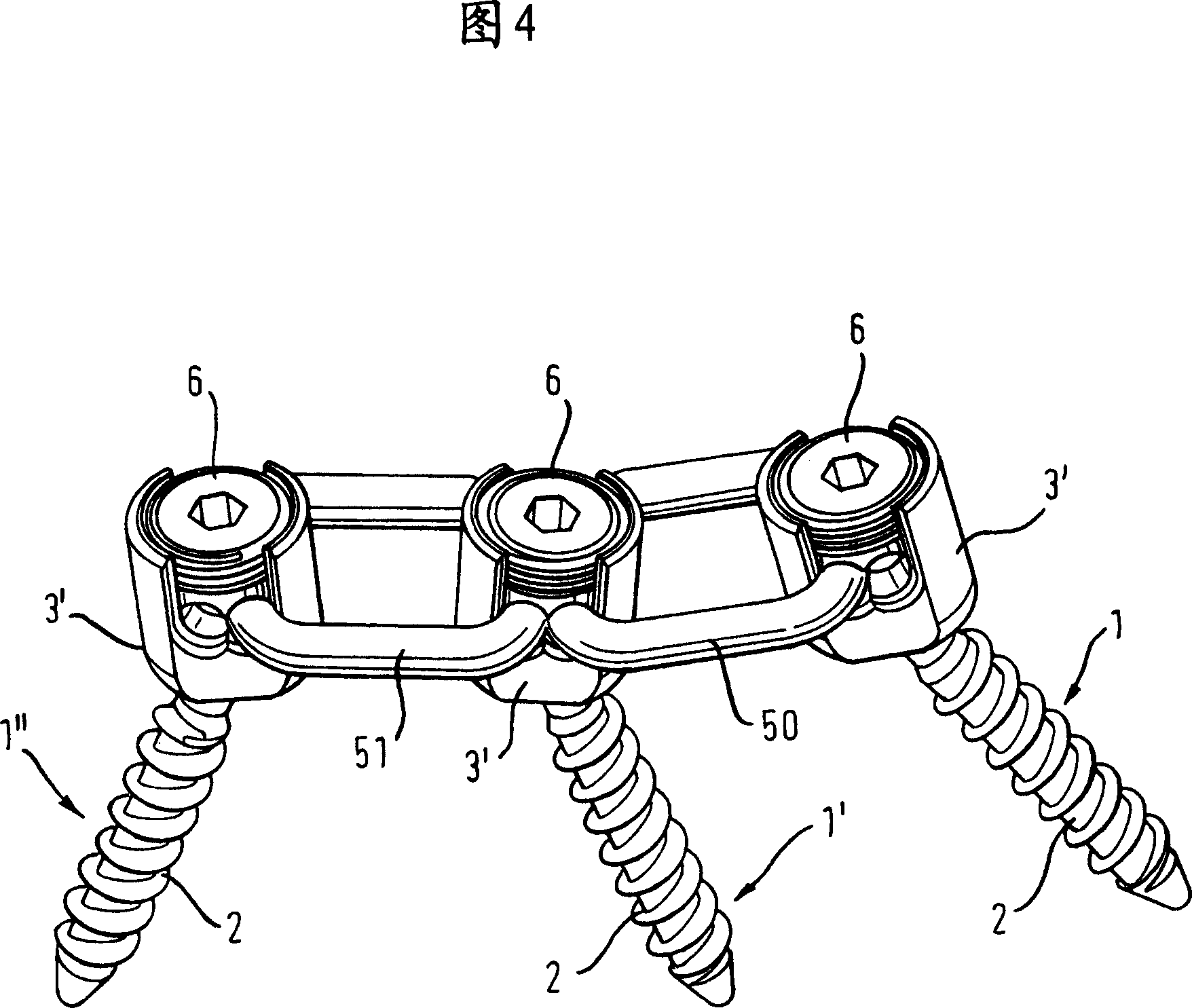 Dynamic stabilization device for bones or vertebrae