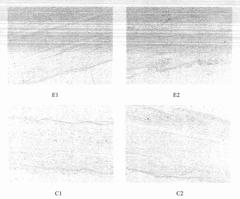 Preparation method of fat emulsion of cerebral protection therapeutic drug