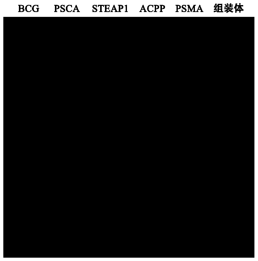 Preparation method of multidimensional multivalence prostatic cancer specificity tumor antigen assembly