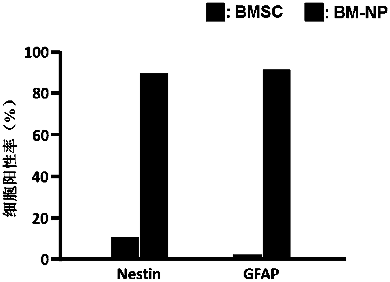 Differentiation culture medium and preparation method of oligodendrocyte progenitor cells