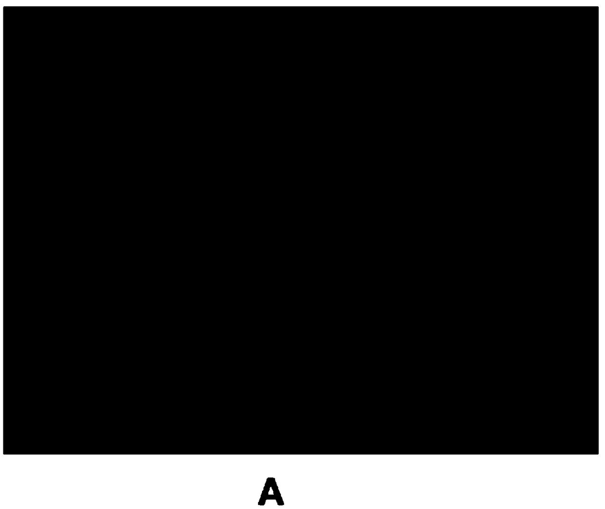 Differentiation culture medium and preparation method of oligodendrocyte progenitor cells