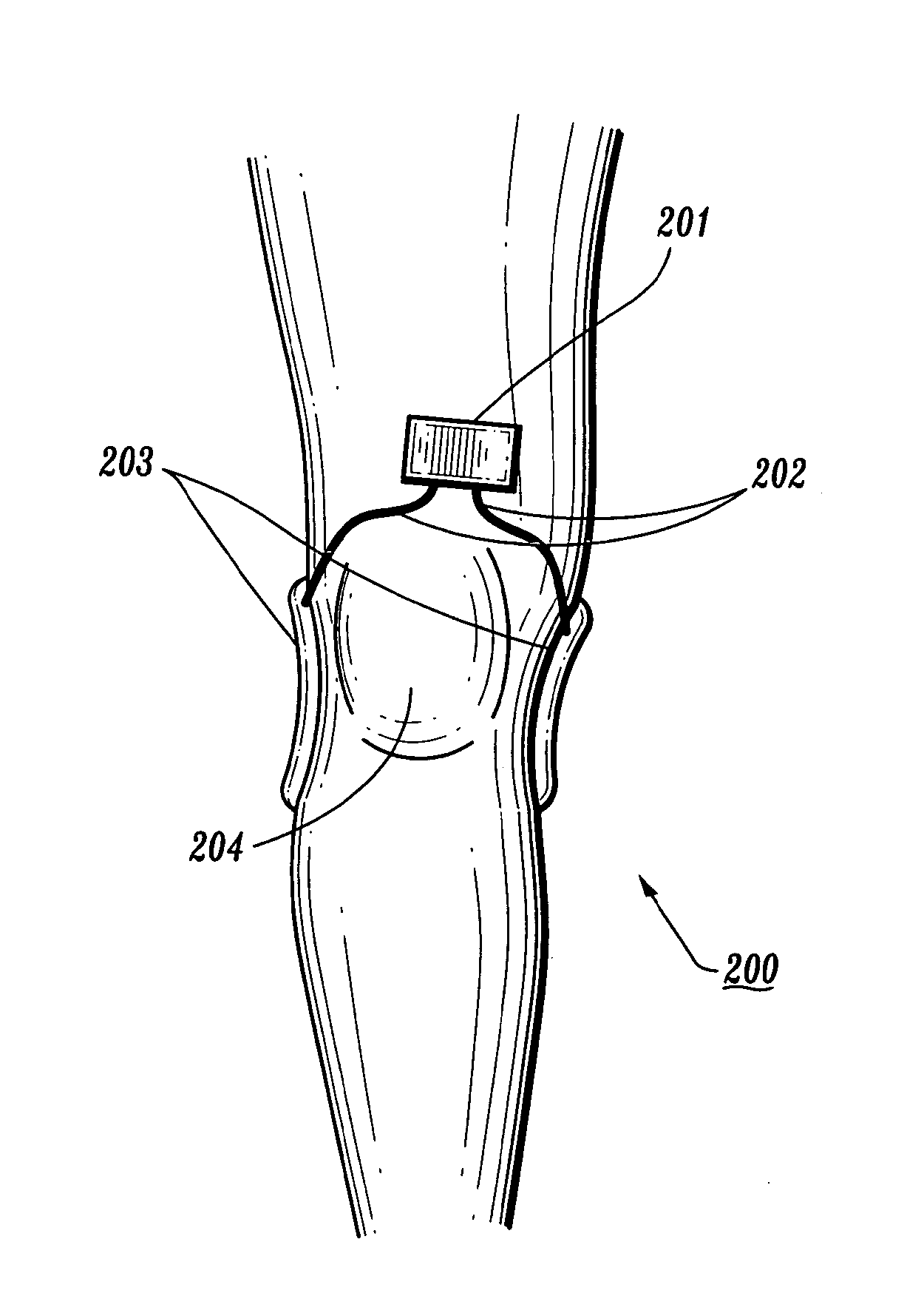 Apparatus and method for electromagnetic treatment of plant, animal, and human tissue, organs, cells, and molecules