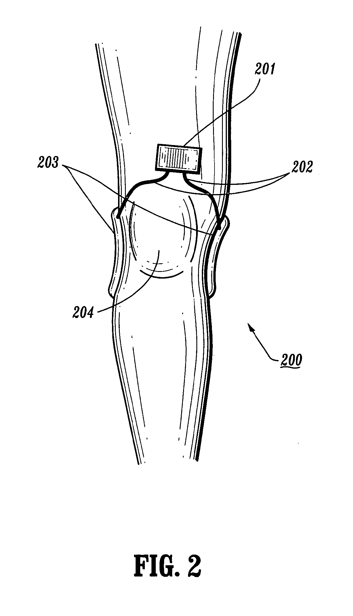 Apparatus and method for electromagnetic treatment of plant, animal, and human tissue, organs, cells, and molecules