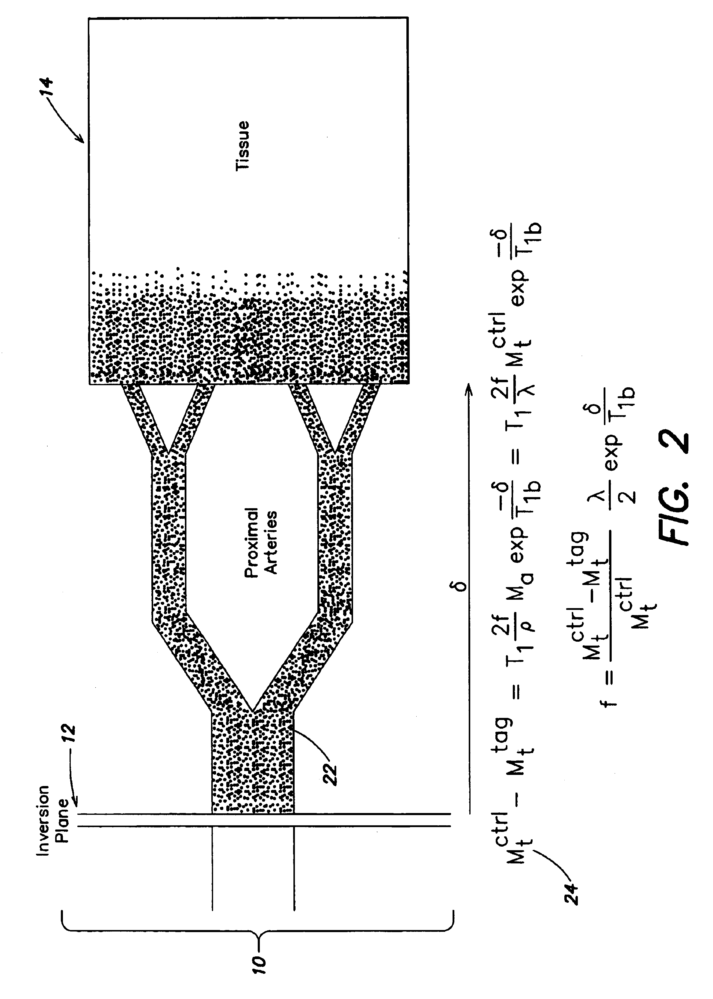 Arterial spin labeling using time varying gradients