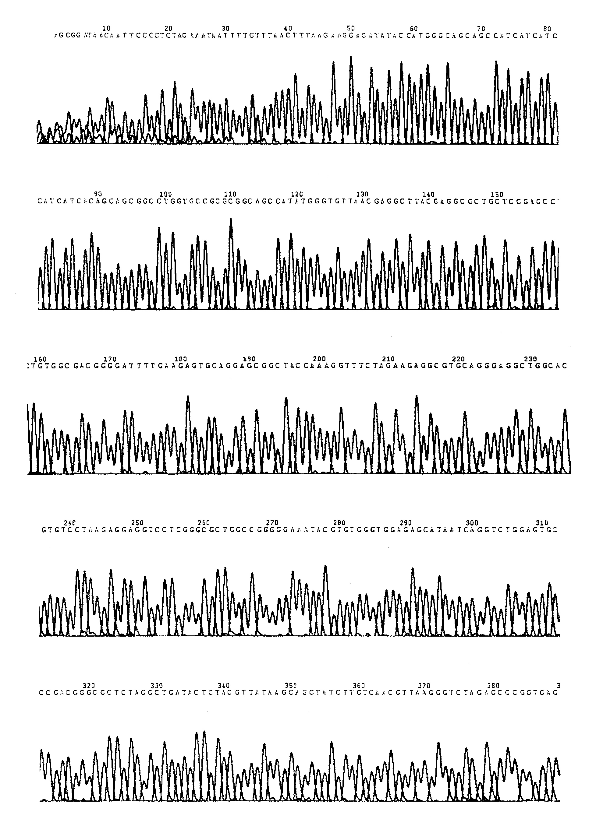 Thermophilic esterase/phosphatidase gene, engineering bacteria, enzyme and use thereof