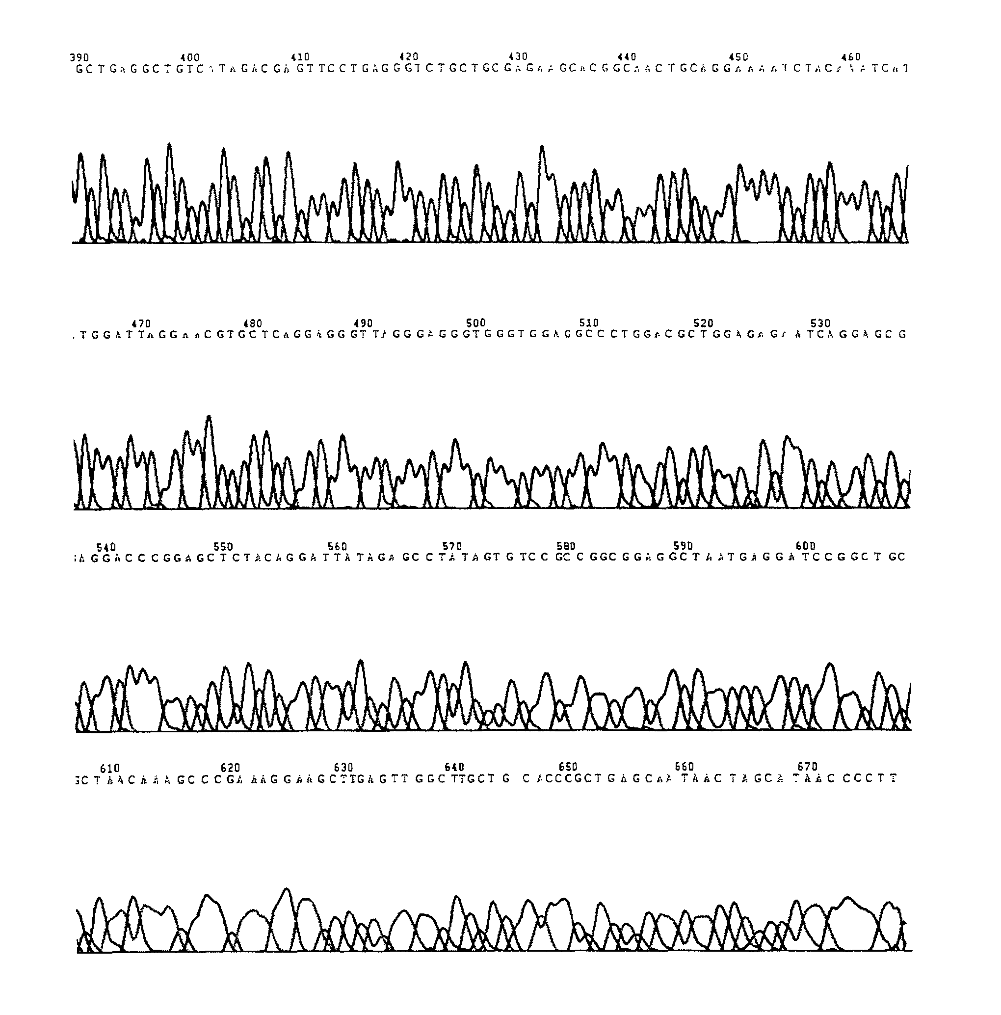 Thermophilic esterase/phosphatidase gene, engineering bacteria, enzyme and use thereof