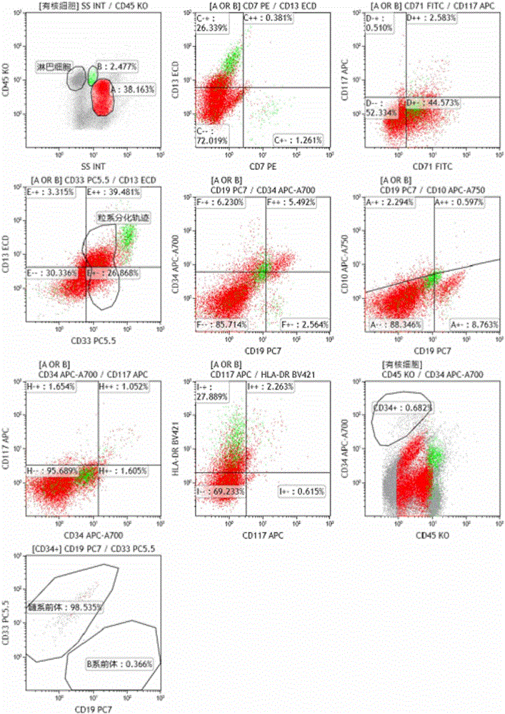 Ten-color antibody composition and application thereof in leukemia-lymphomas subtype