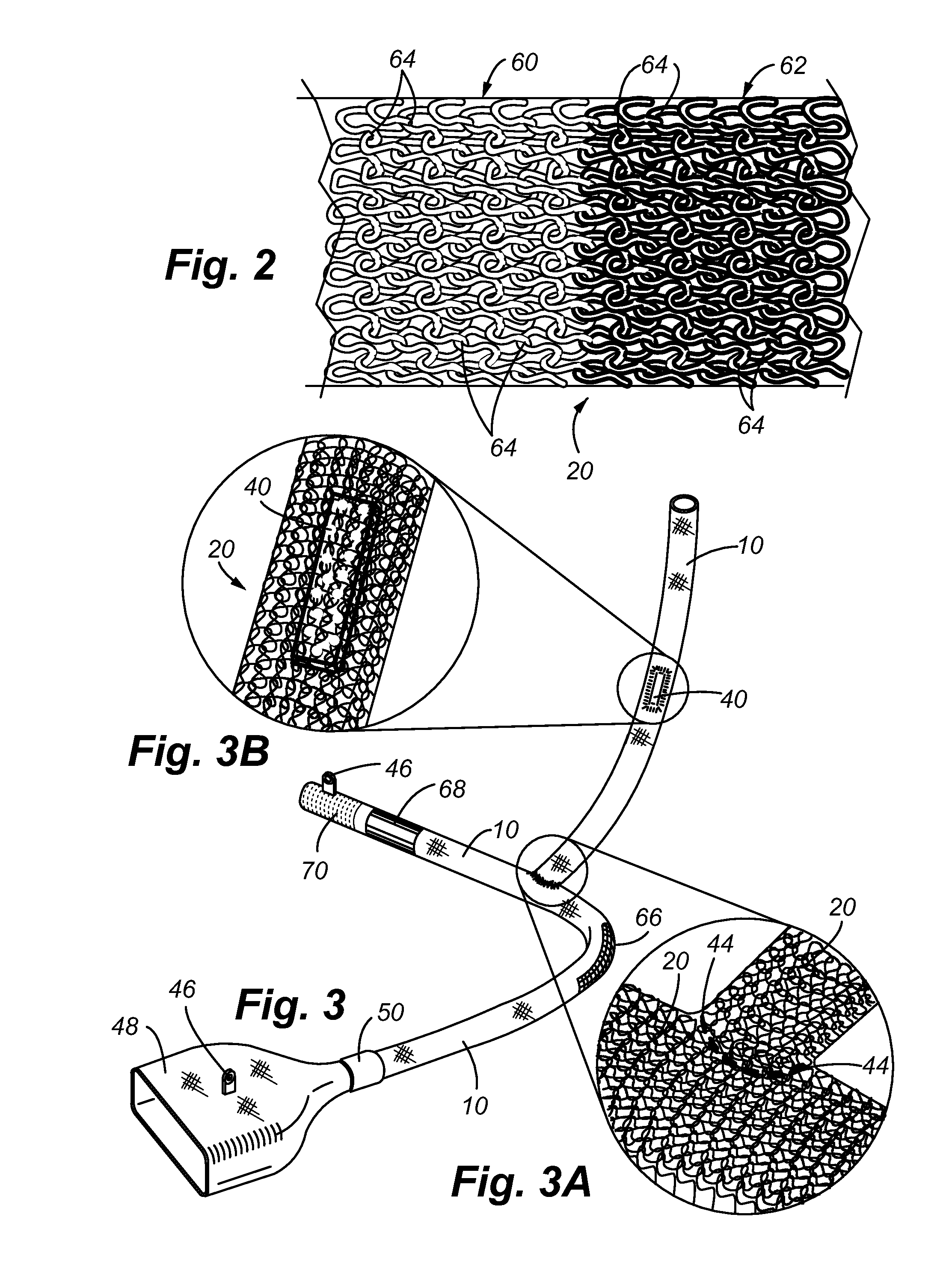 Composite tube for fluid delivery system