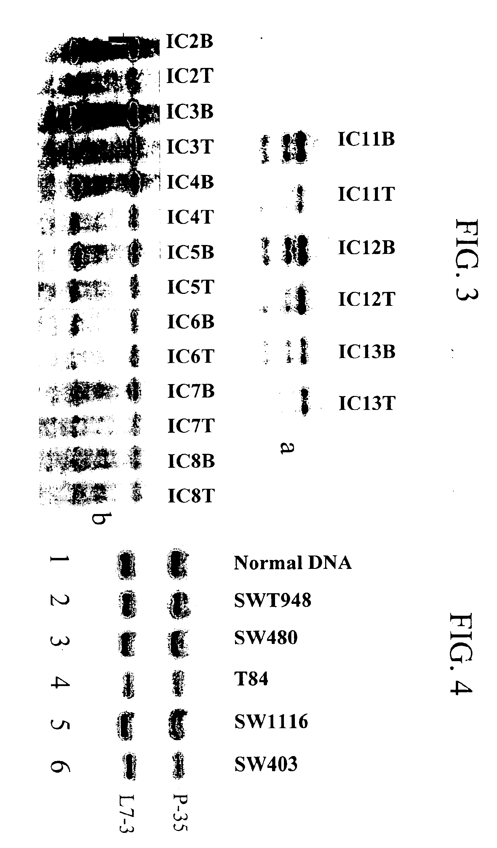 DLC-1 gene deleted in cancers