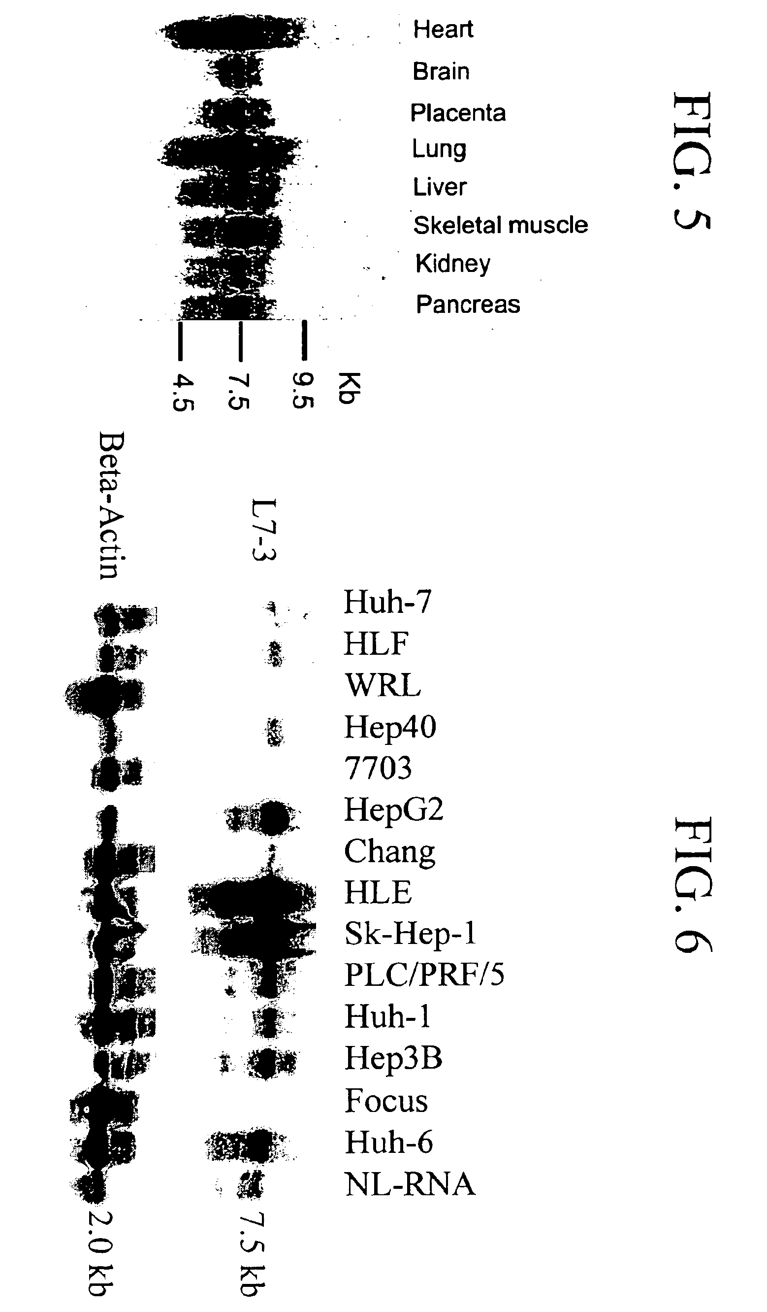 DLC-1 gene deleted in cancers