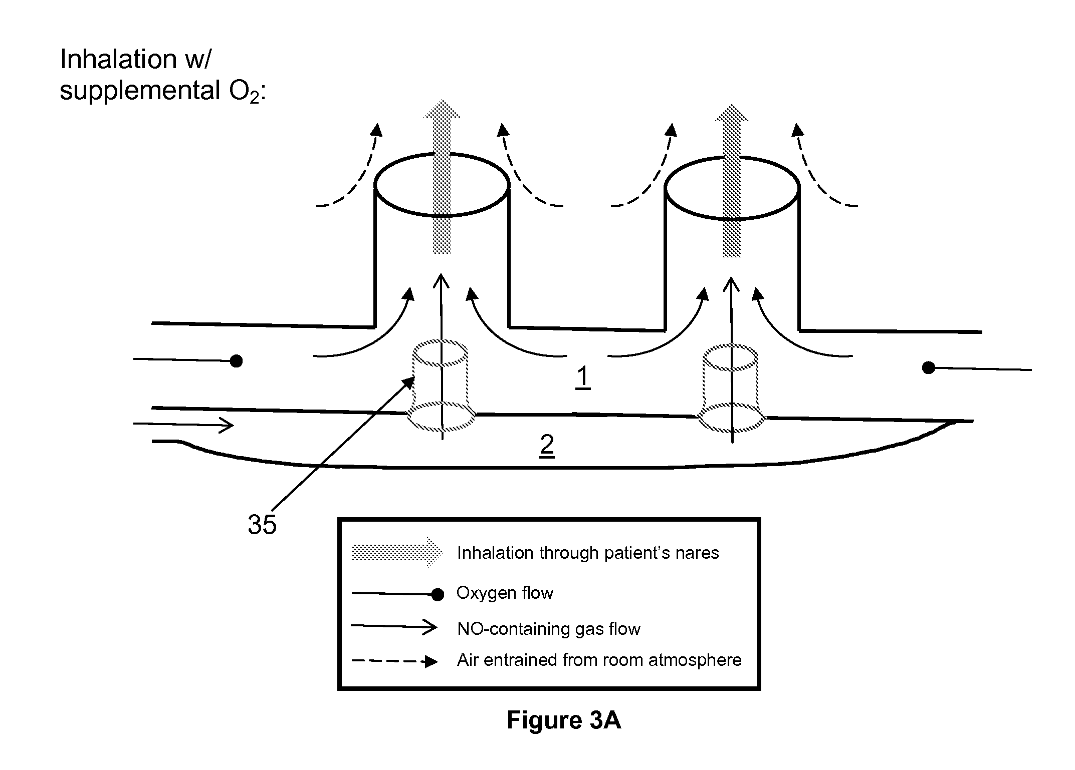 Nasal cannula assembly with flow control passage communicating with a deformable reservoir