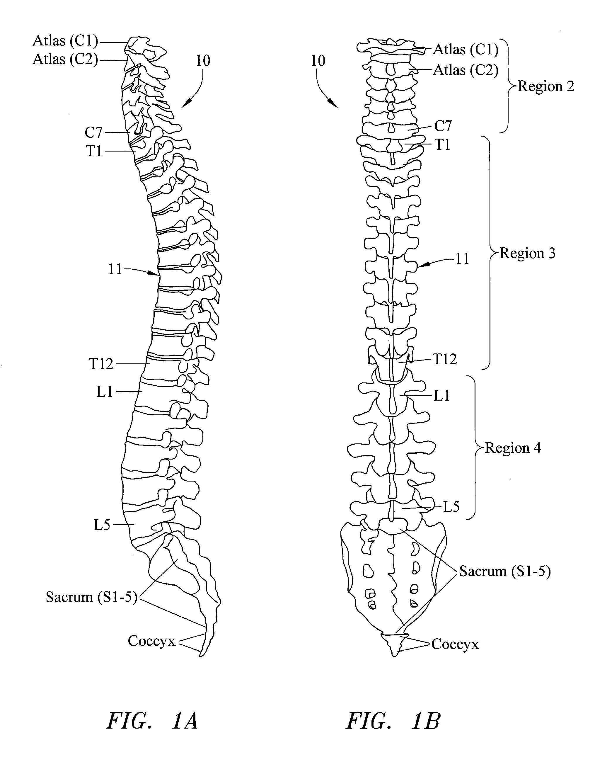 Systems, Devices and Methods for the Correction of Spinal Deformities