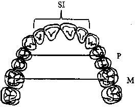 Method for preparing a partial or full dental prothesis