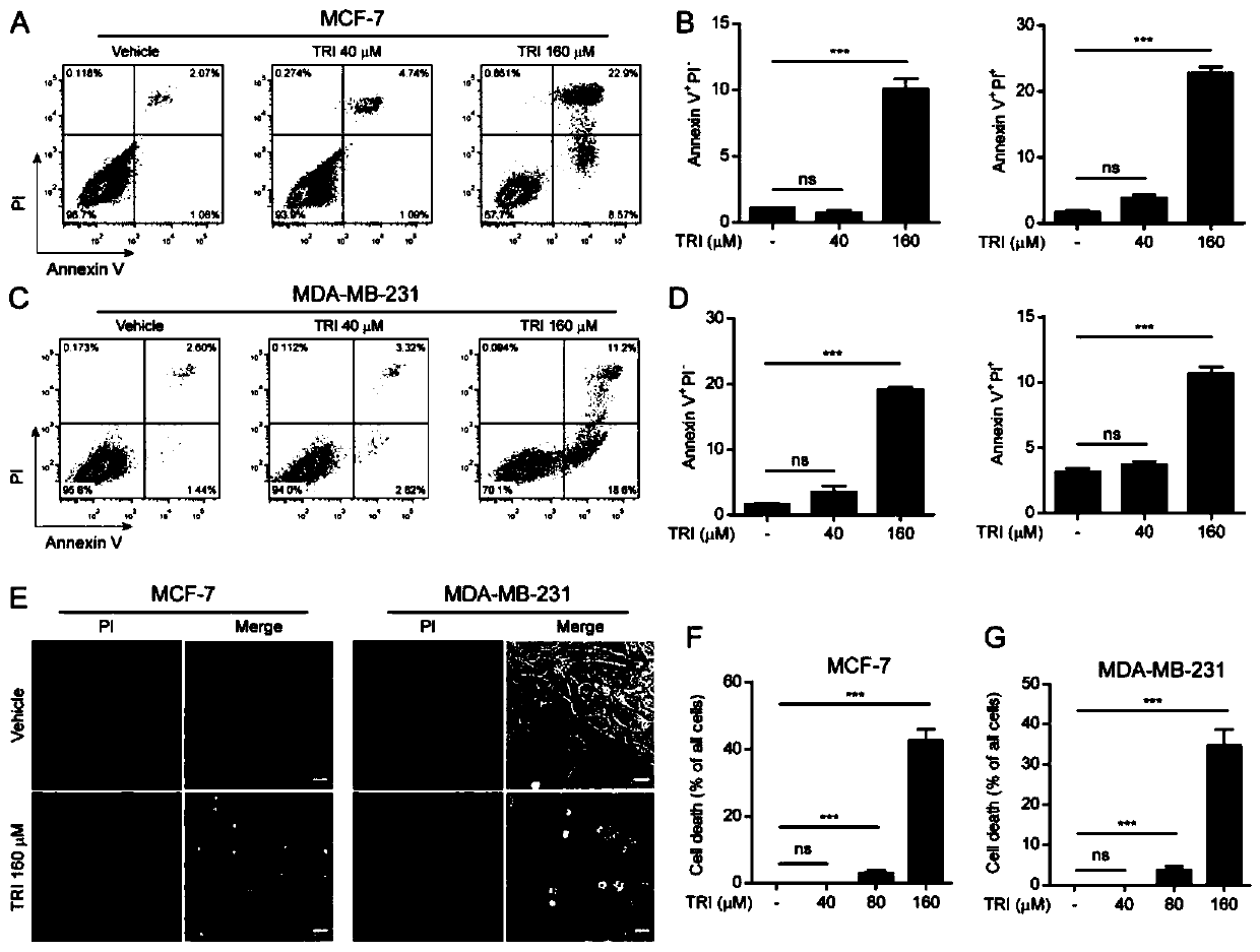 Application of triclabendazole in preparation of drugs for treating breast cancer