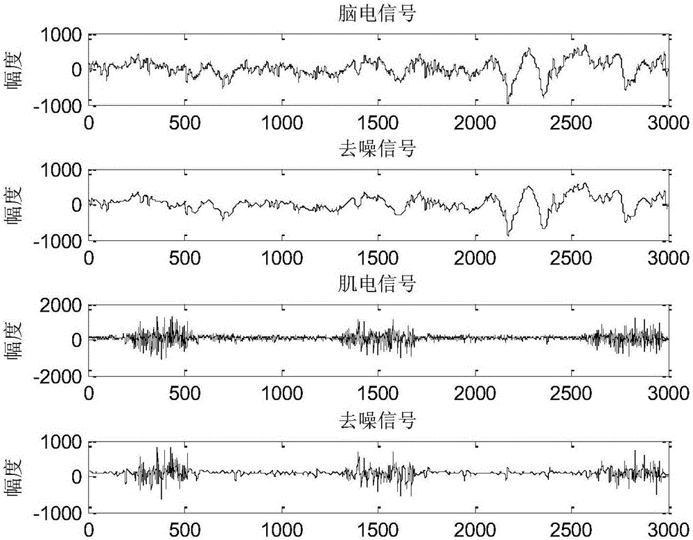 Automatic sleep staging method based on multiple electroencephalogram and electromyography characteristics