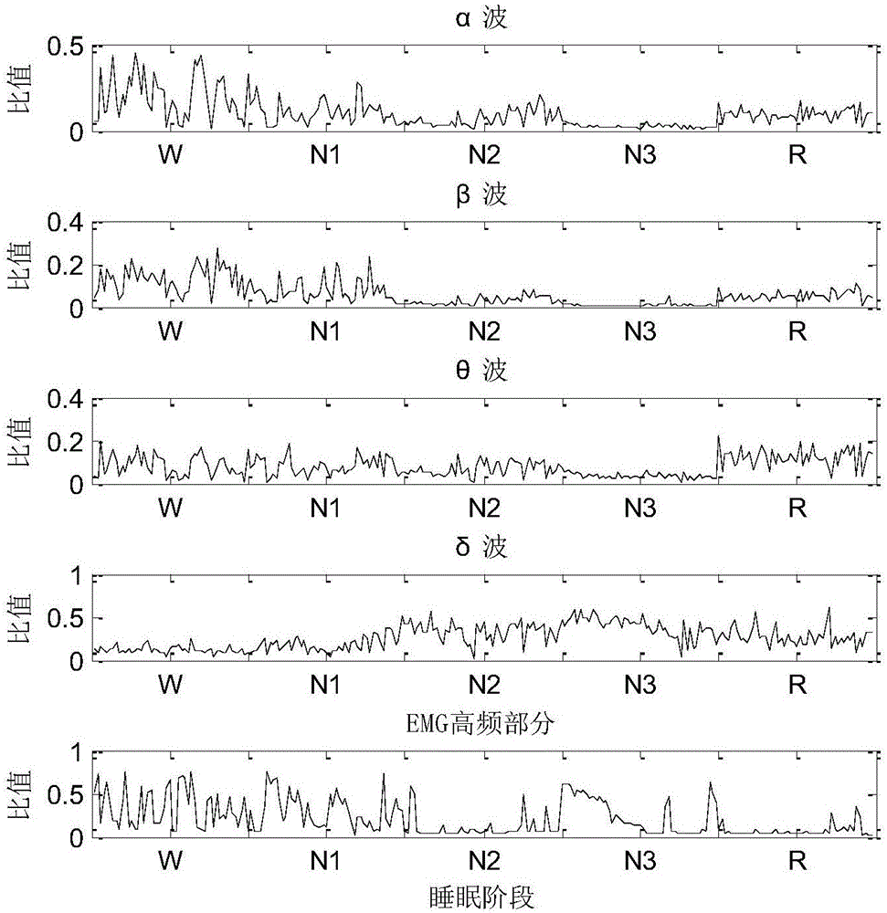 Automatic sleep staging method based on multiple electroencephalogram and electromyography characteristics