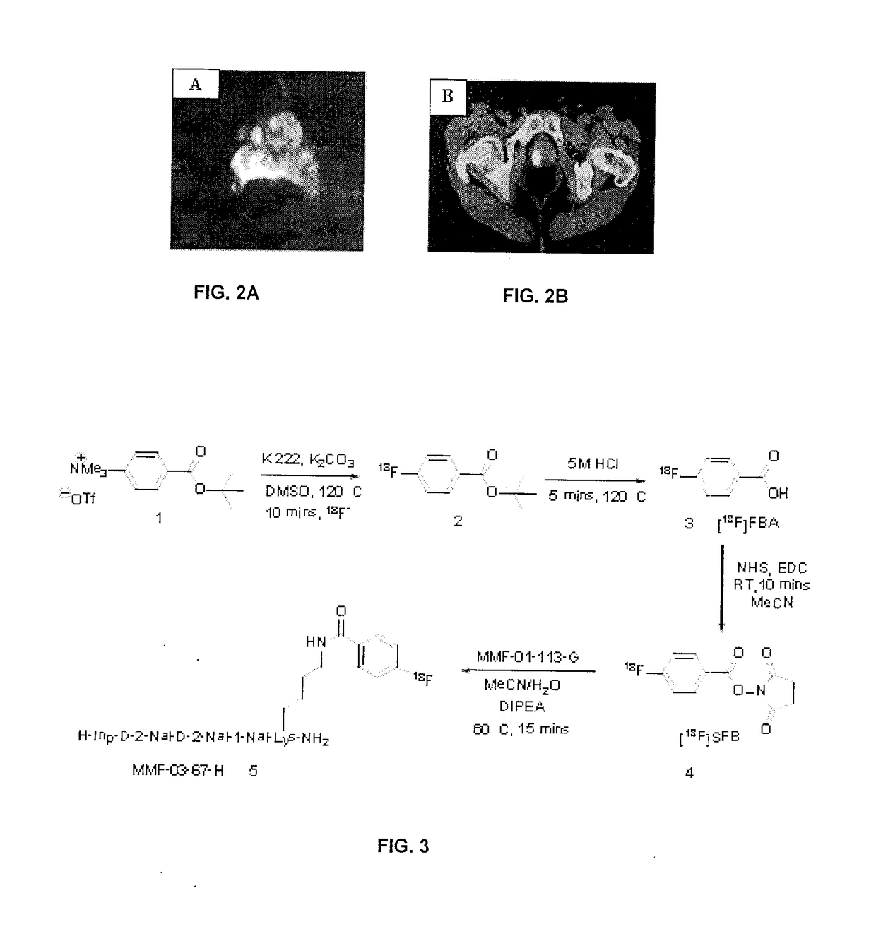 Peptidomimetics for imaging the ghrelin receptor