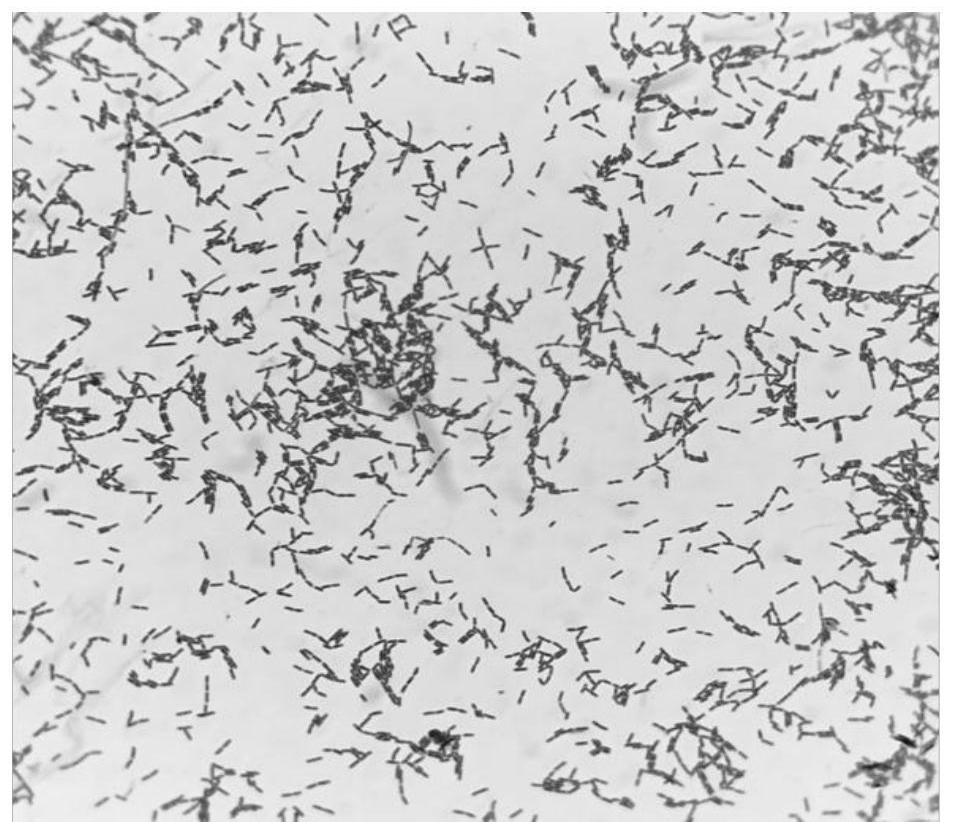 Application of Lactobacillus paracasei l.p R3-10 in the preparation of drugs for preventing or treating oral inflammatory diseases