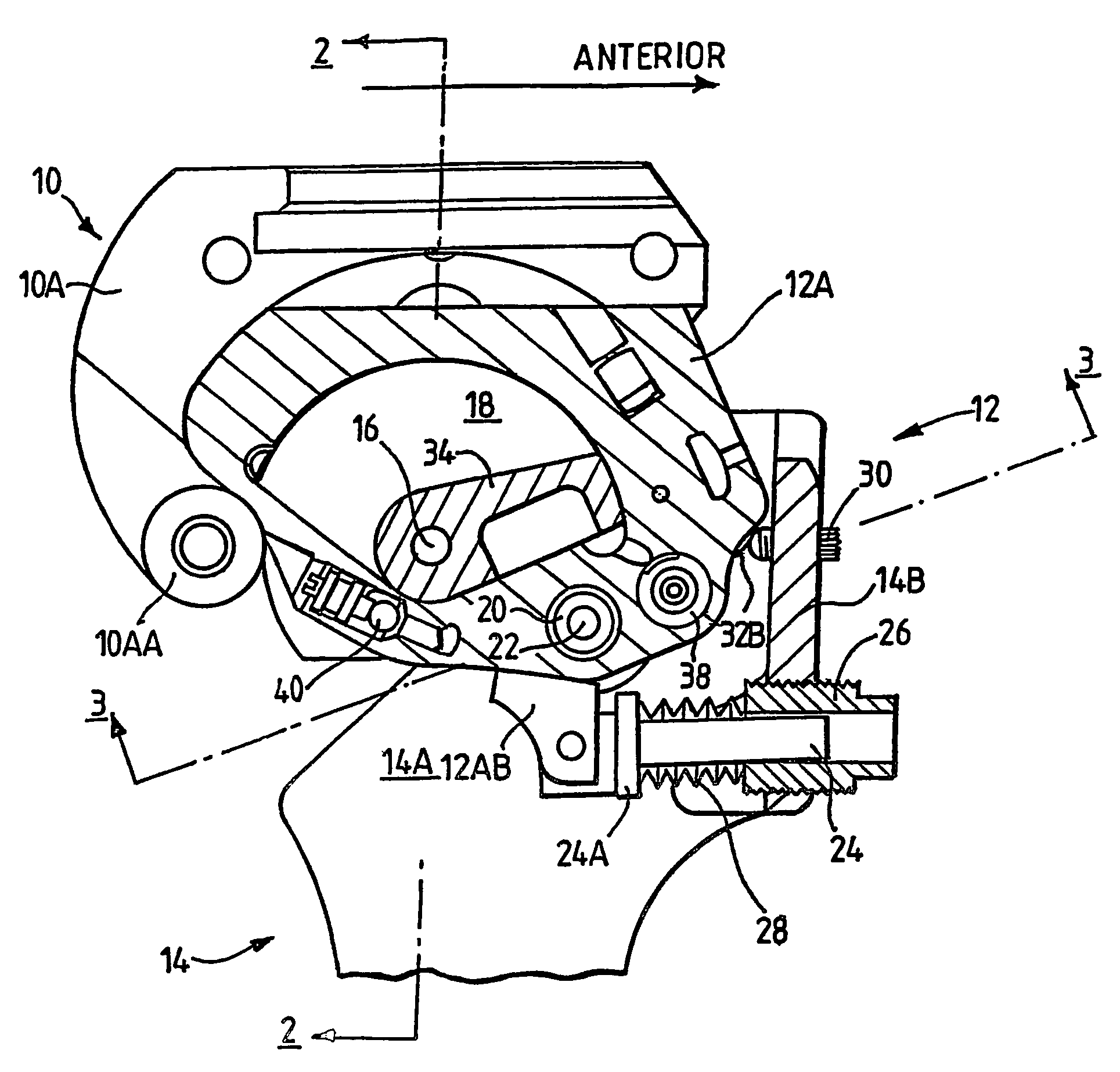 Prosthetic knee joint mechanism