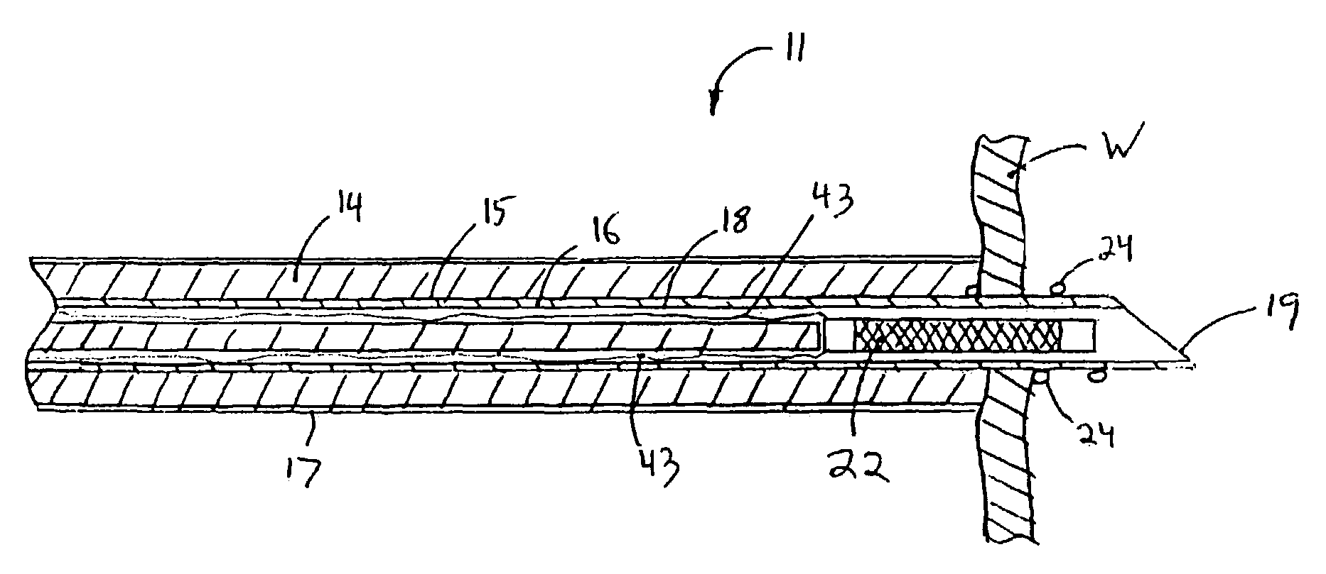 Methods for reduction of a gastric lumen