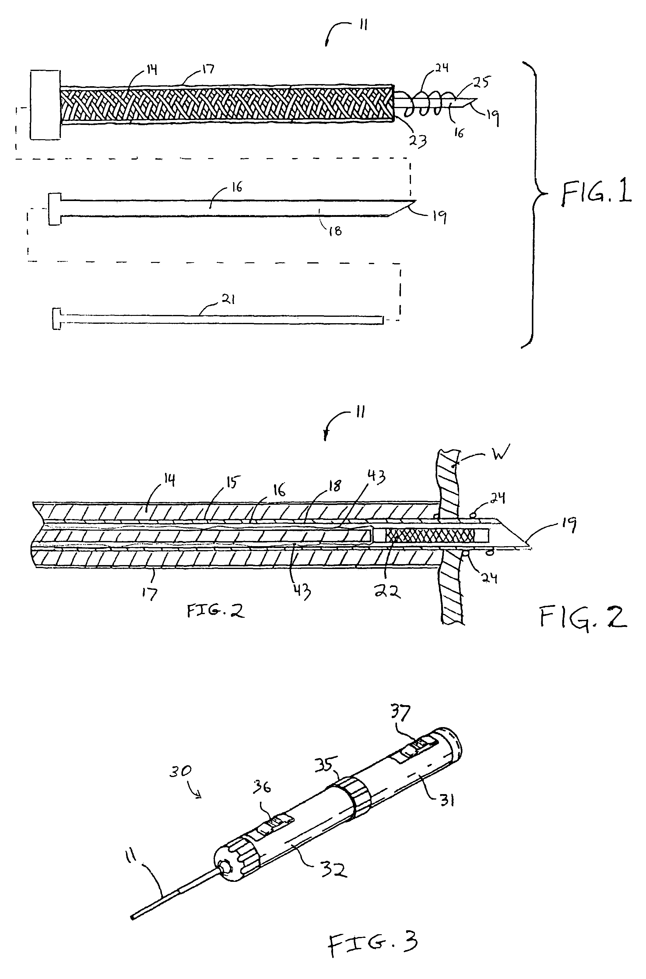 Methods for reduction of a gastric lumen