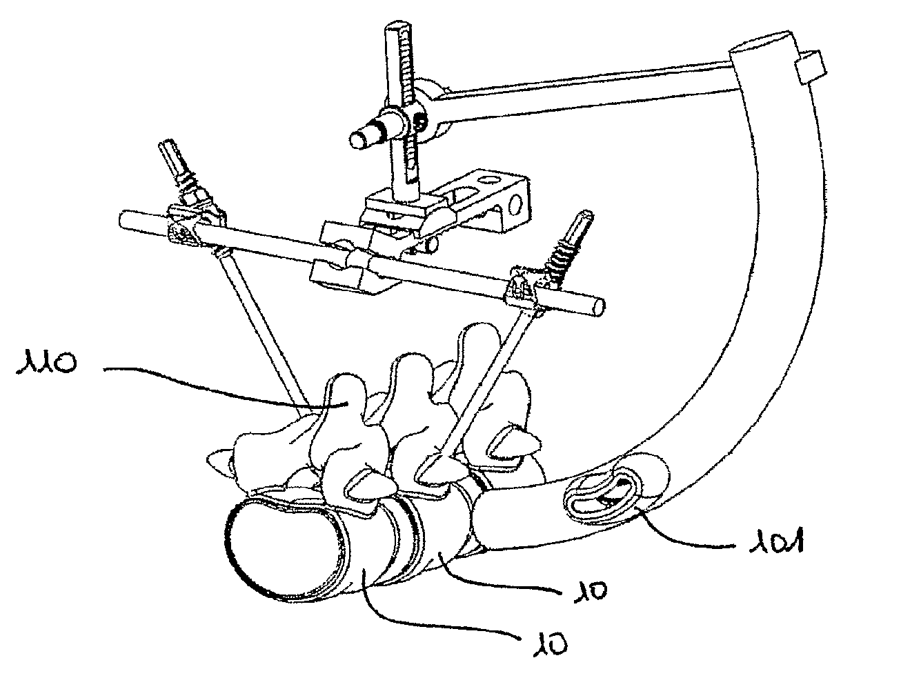 Device for Establishing an Anatomical Reference Point of an Intervertebral Disc