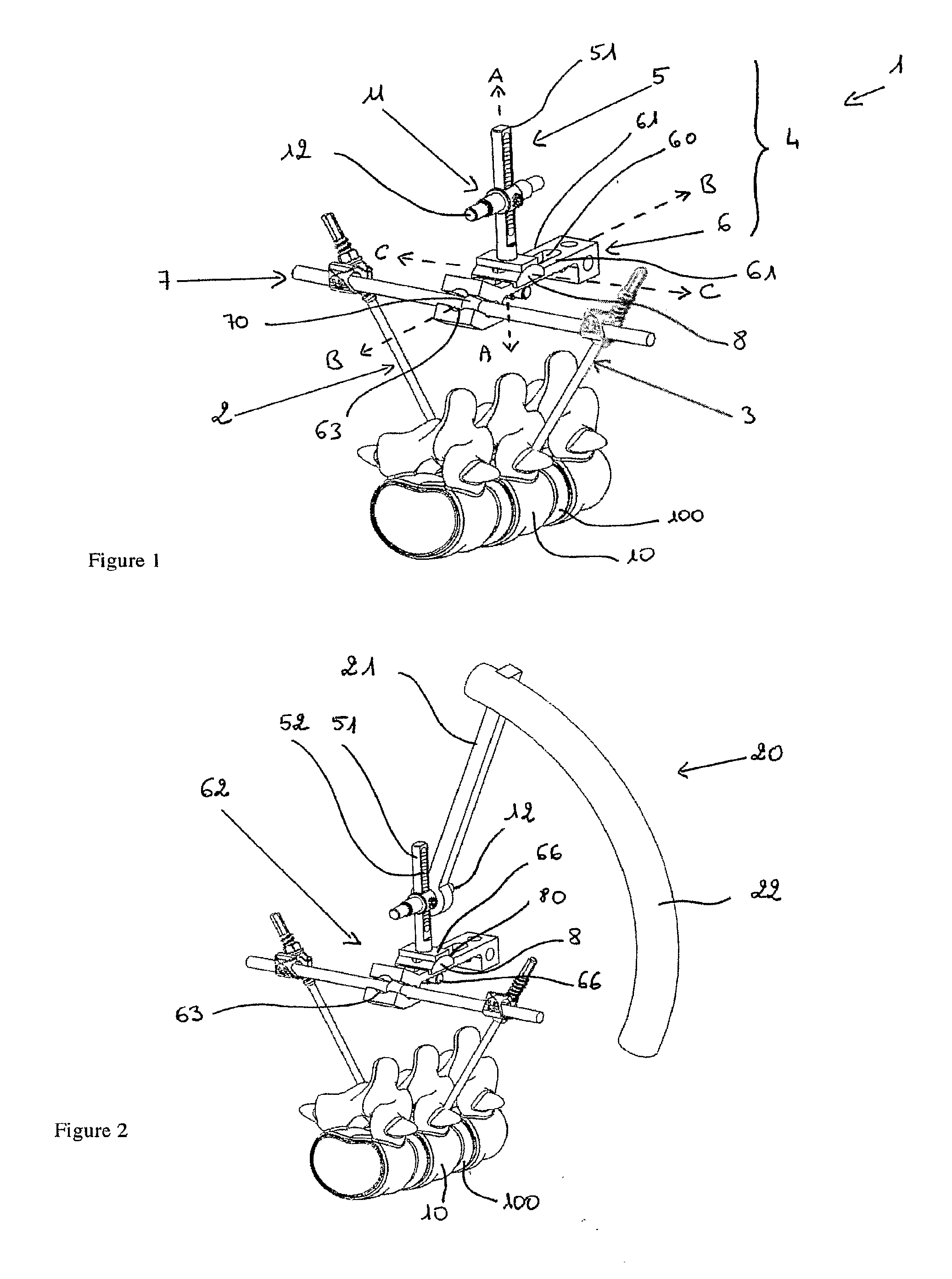 Device for Establishing an Anatomical Reference Point of an Intervertebral Disc