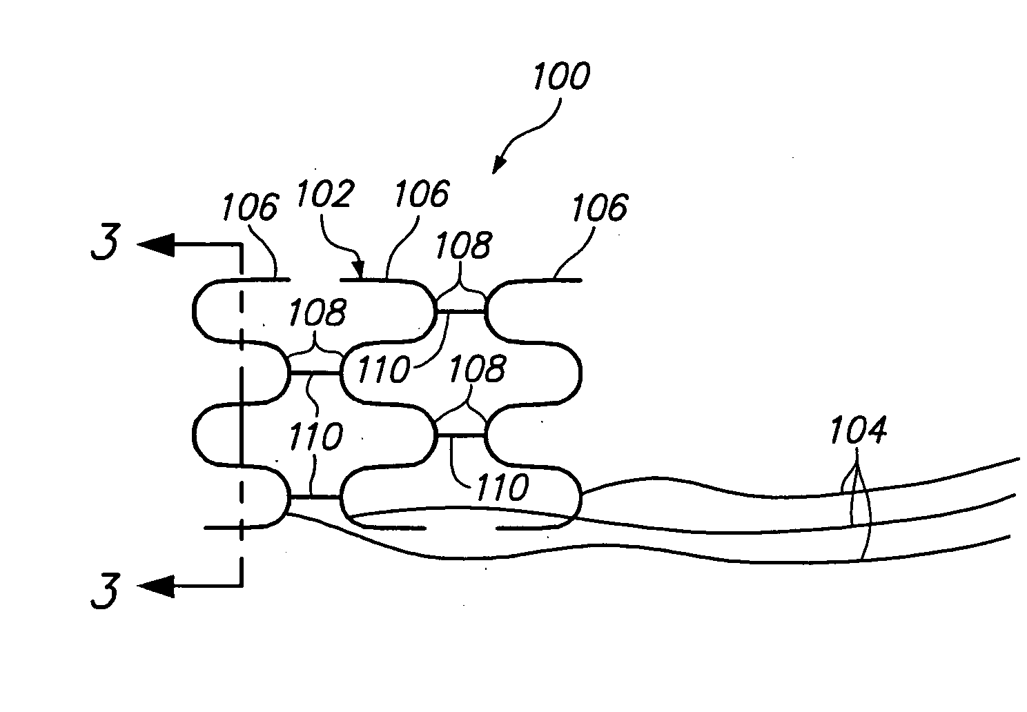 Intravascular self-anchoring integrated tubular electrode body