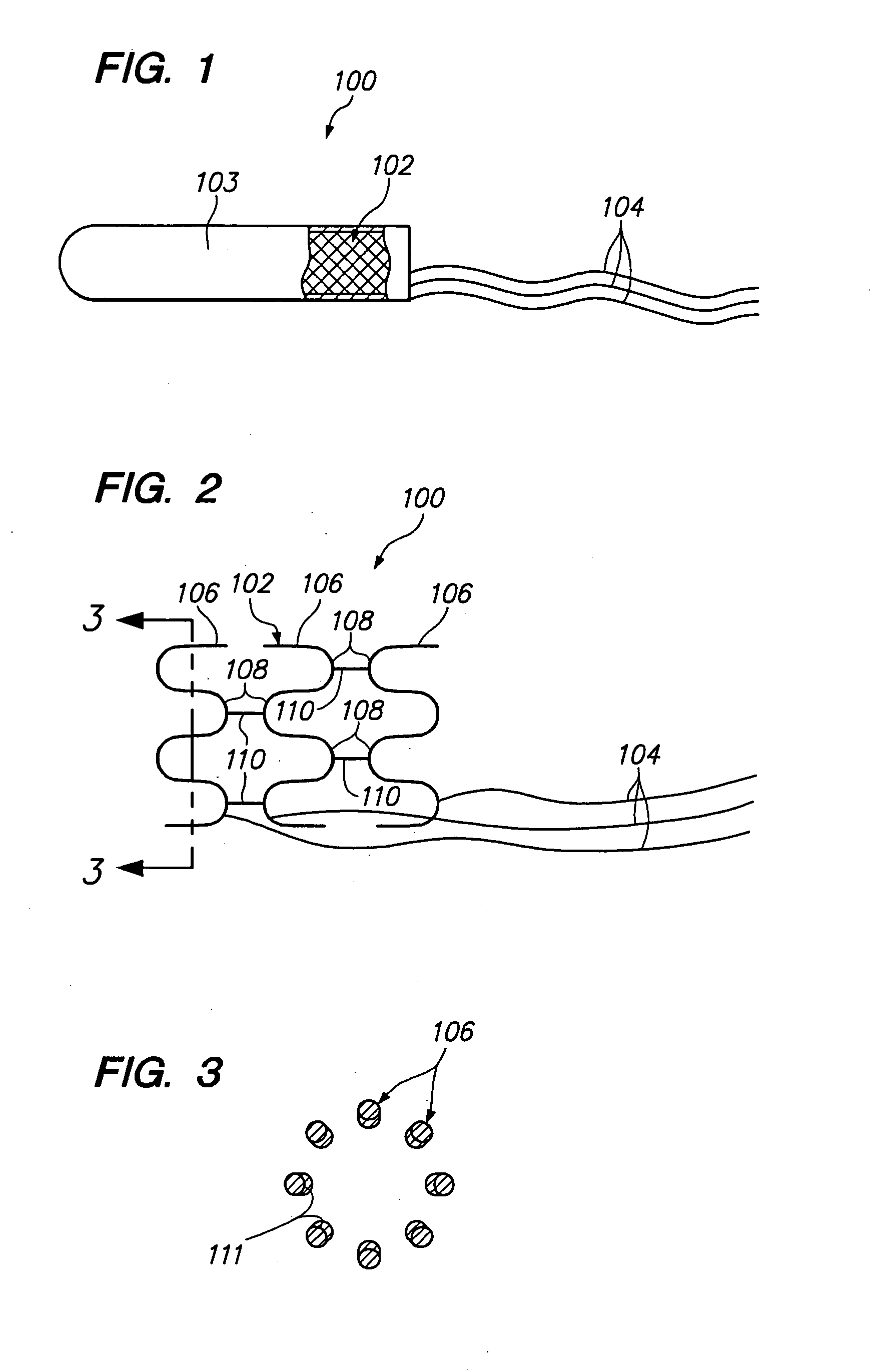 Intravascular self-anchoring integrated tubular electrode body