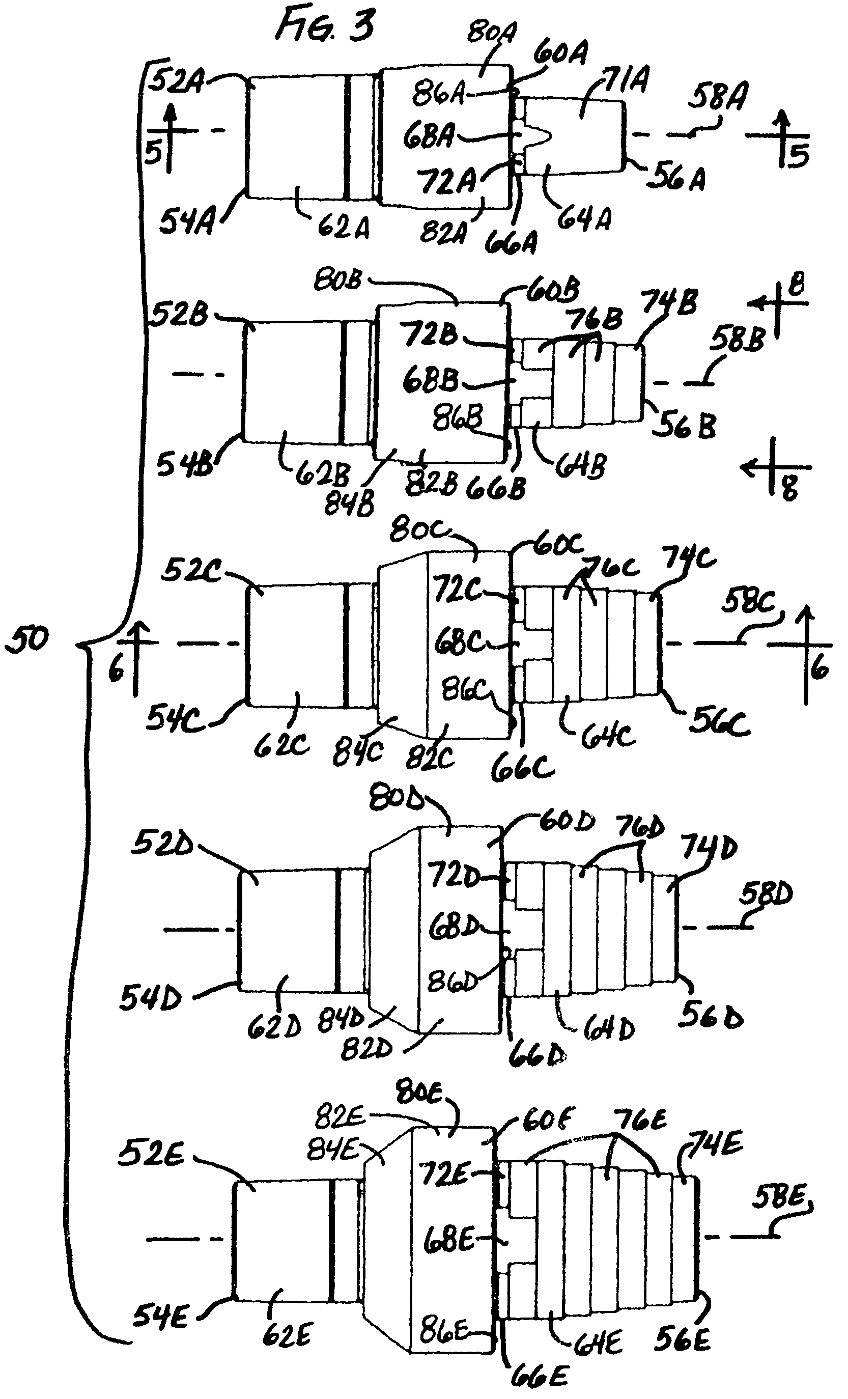 Modular implant system and method with diaphyseal implant