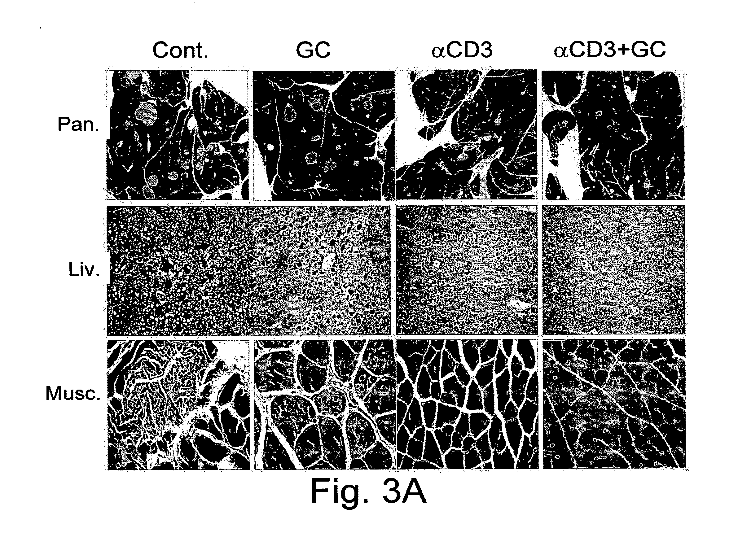 Combination Therapy of Beta-Glycolipids and Antibodies for the Treatment of Immune-Related Disorders