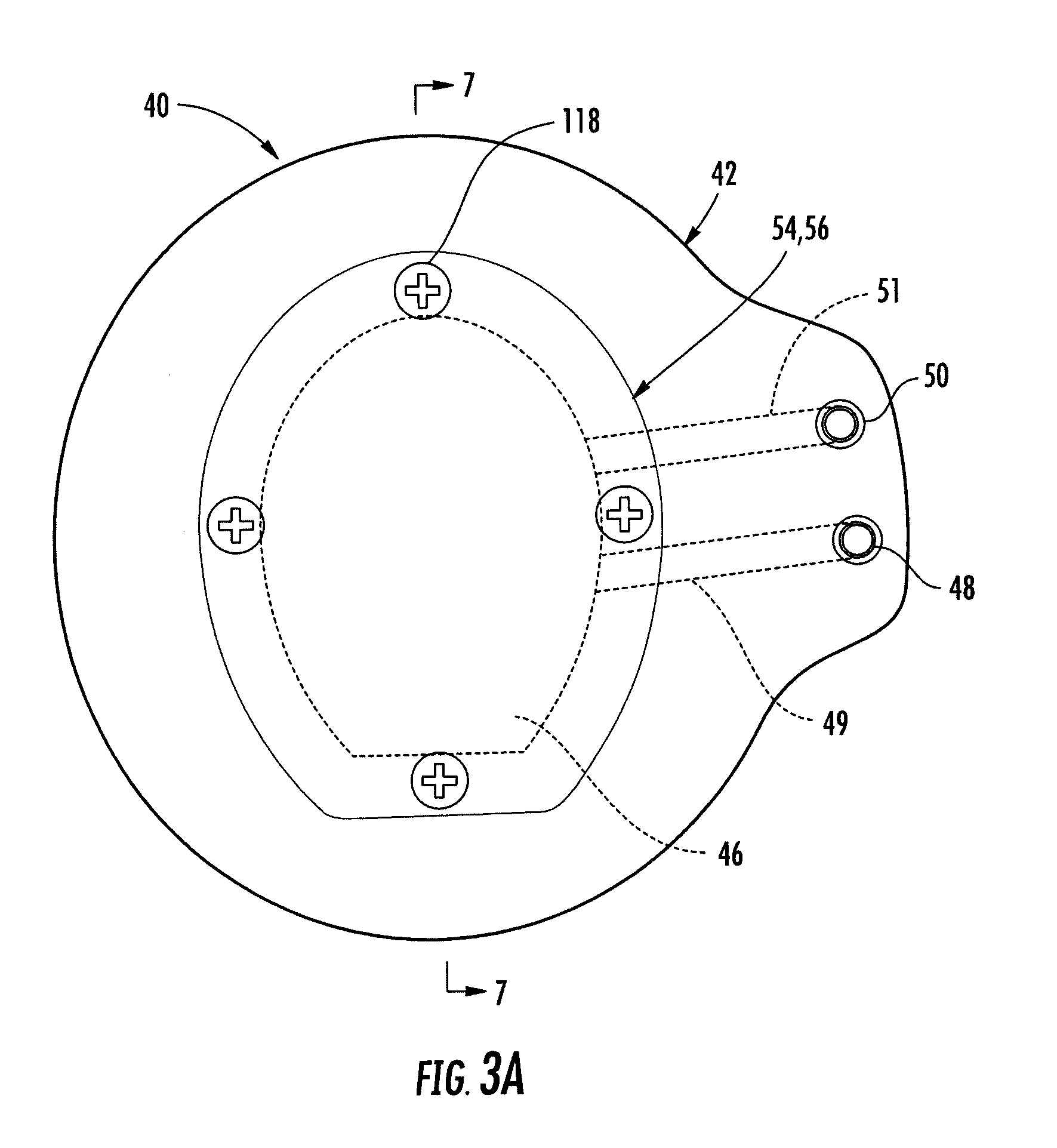 Cryotherapy device for treatment or prevention of laminitis in equine