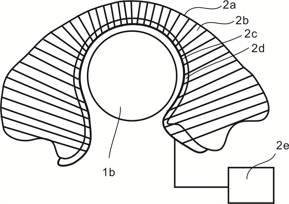 Thyroid nodule model