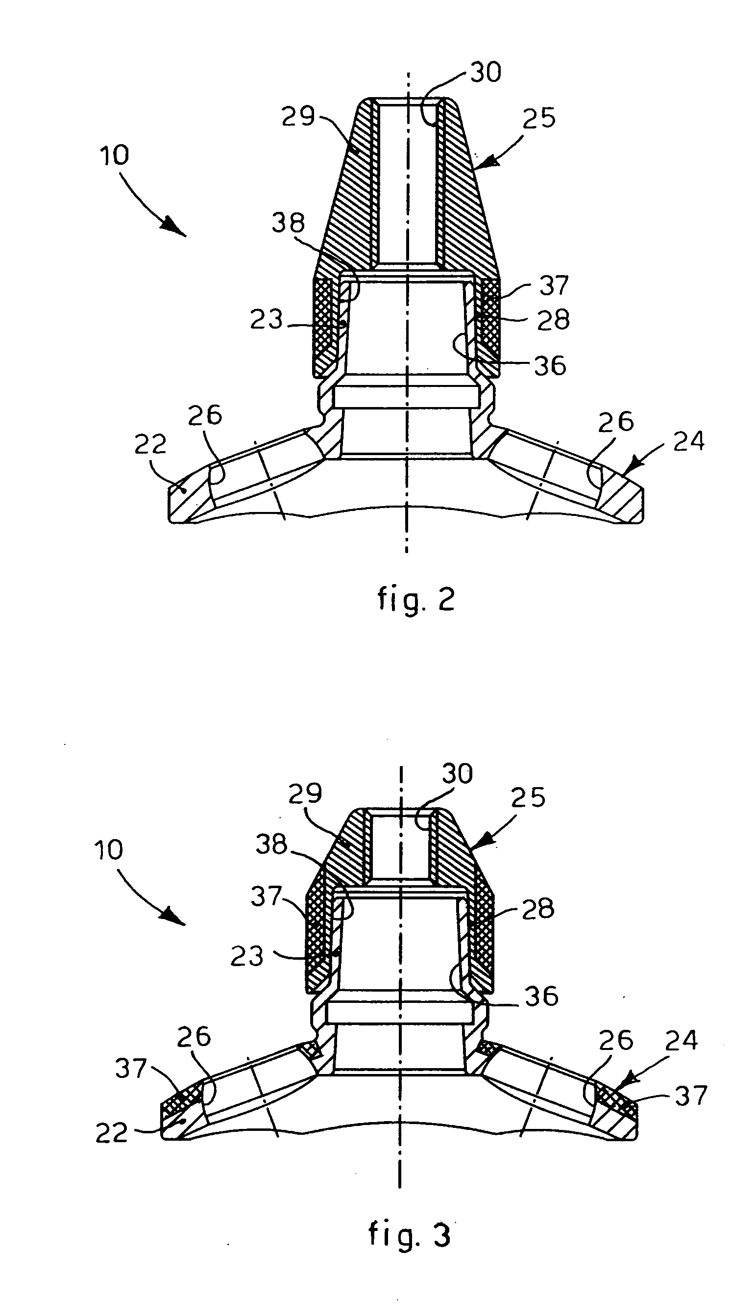 Glenoid support for shoulder prosthesis