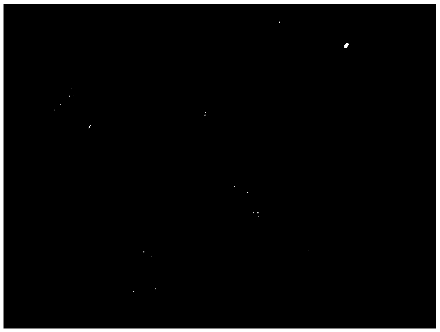 Human endometrial stromal cell separation and primary culture method