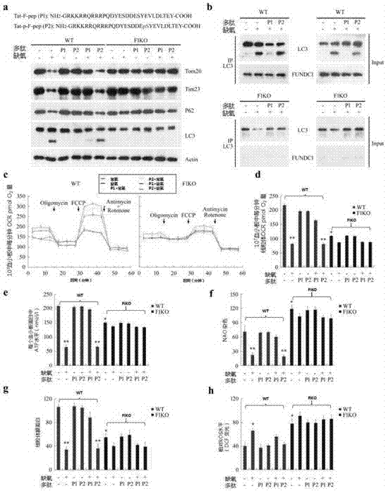 Medicine for regulating platelet activity, screening method and application of medicine