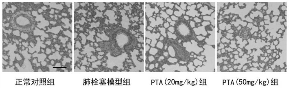 Application of compound in preparation of medicine for treating acute pulmonary embolism