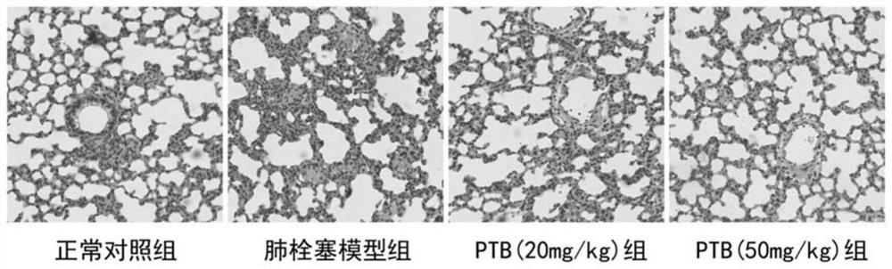 Application of compound in preparation of medicine for treating acute pulmonary embolism