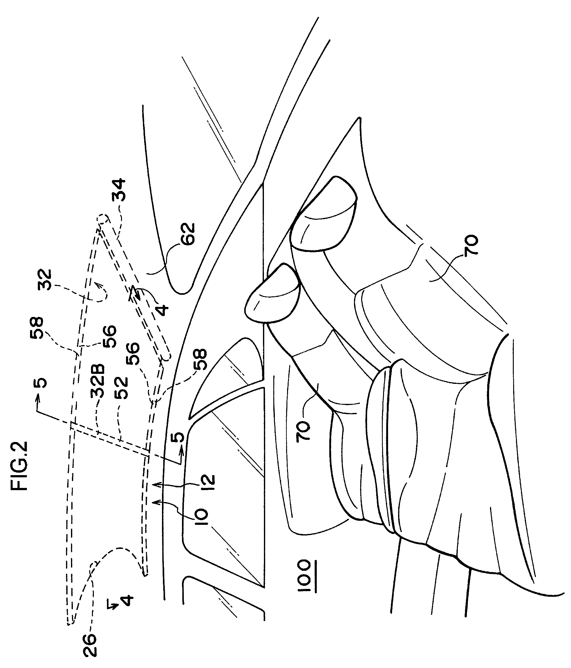 Vehicle roof structure