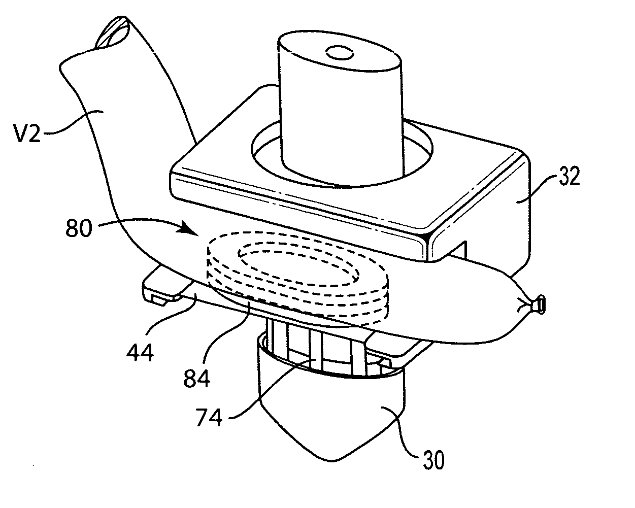 Methods, devices and systems for forming magnetic anastomoses