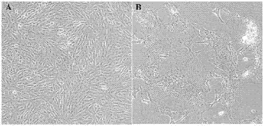 Porcine epidemic diarrhea, porcine delta coronavirus bivalent inactivate vaccine and preparation method thereof